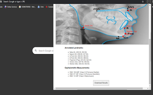 Lateral Cephalometric Analysis from Chrome web store to be run with OffiDocs Chromium online Lateral Cephalometric Analysis from Chrome web store to be run with OffiDocs Chromium online