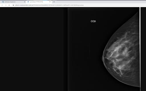 Orthanc Instance2Image from Chrome web store to be run with OffiDocs Chromium online Orthanc Instance2Image from Chrome web store to be run with OffiDocs Chromium online